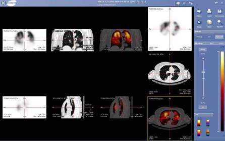 mediciine06
